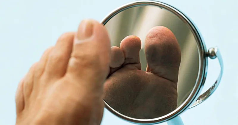 Il piede diabetico: quando la salute parte dal basso